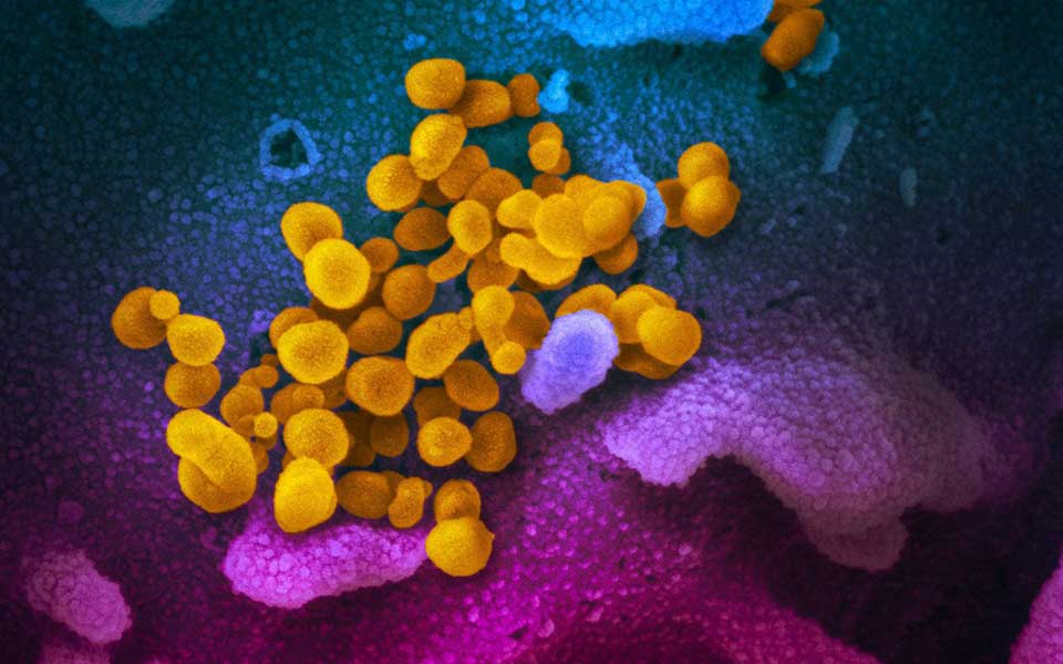 Coronaviren des neuen Typs SARS-CoV-2 beim Austritt aus menschlichen Zellen